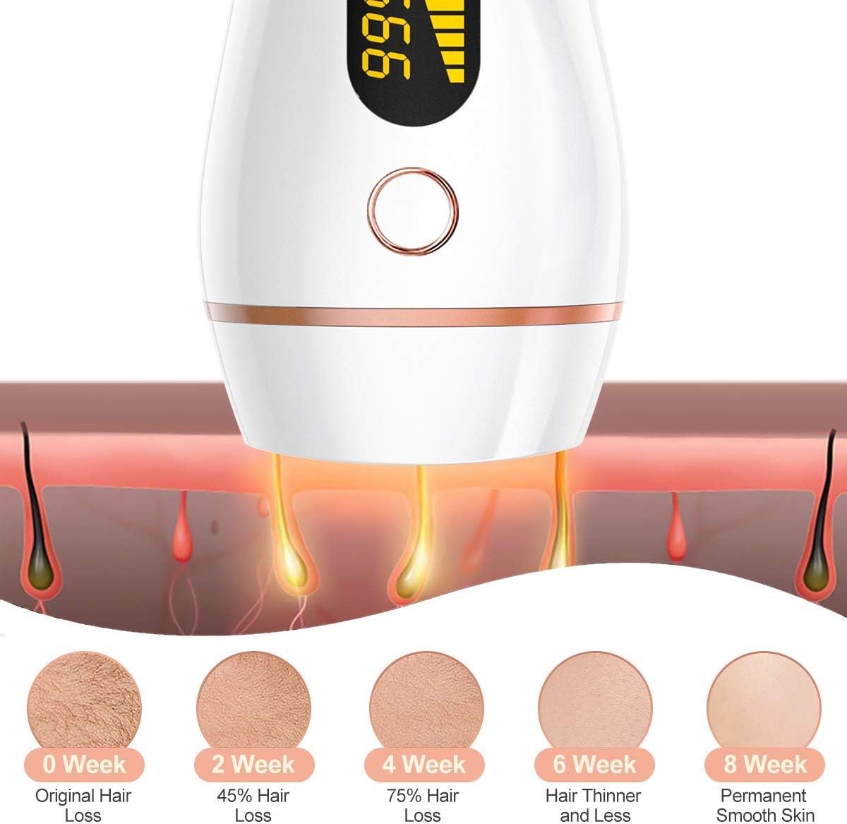 Hair Remover Haarverwijderaar Gezicht & Lichaam Unisex
