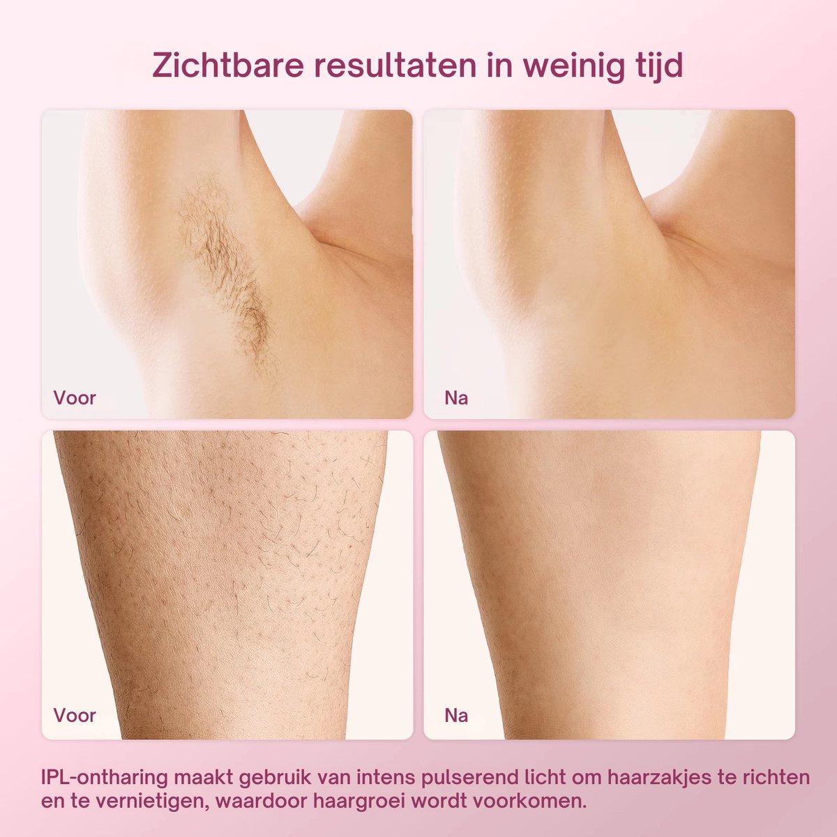 IBORRIA T4 Compact IPL Laser Ontharingsapparaat Roze