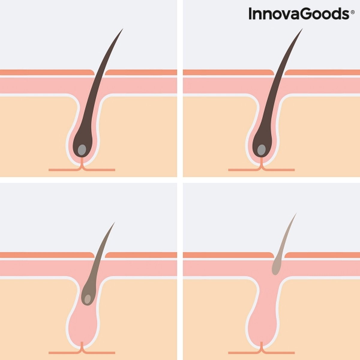 Wat vinden we goed aan de Innovagoods Epilator Dames