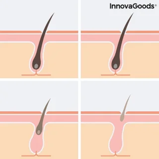 Innovagoods Epilator Dames