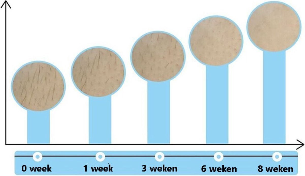 Intimi IPL Slim Laser Ontharingsapparaat voor Mannen en Vrouwen