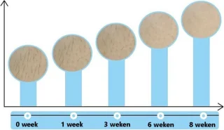 Intimi IPL Slim Laser Ontharingsapparaat voor Mannen en Vrouwen