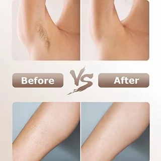 IPL Epilator