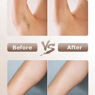 IPL Epilator