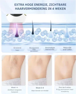 IPL Haarlaser Epilator Set Cooler Bevriezer Gratis Zonnebril Scheermesje