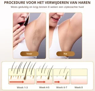 IPL Laser Ontharingsapparaat 3-in-1 voor Gezicht en Lichaam
