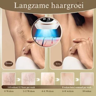 IPL Laser Ontharingsapparaat 999.999 Flitsen Gezicht & Lichaam