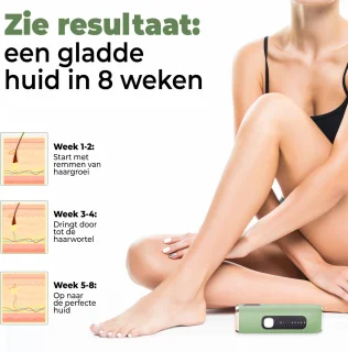 IPL Laser Ontharingsapparaat 999.999 Flitsen Inclusief Accessoires
