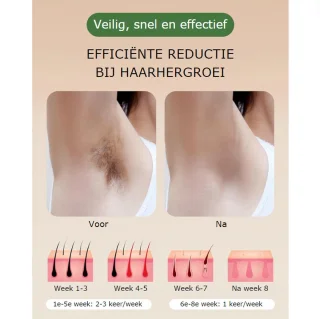 IPL Laser Ontharingsapparaat 999.999 Flitsen