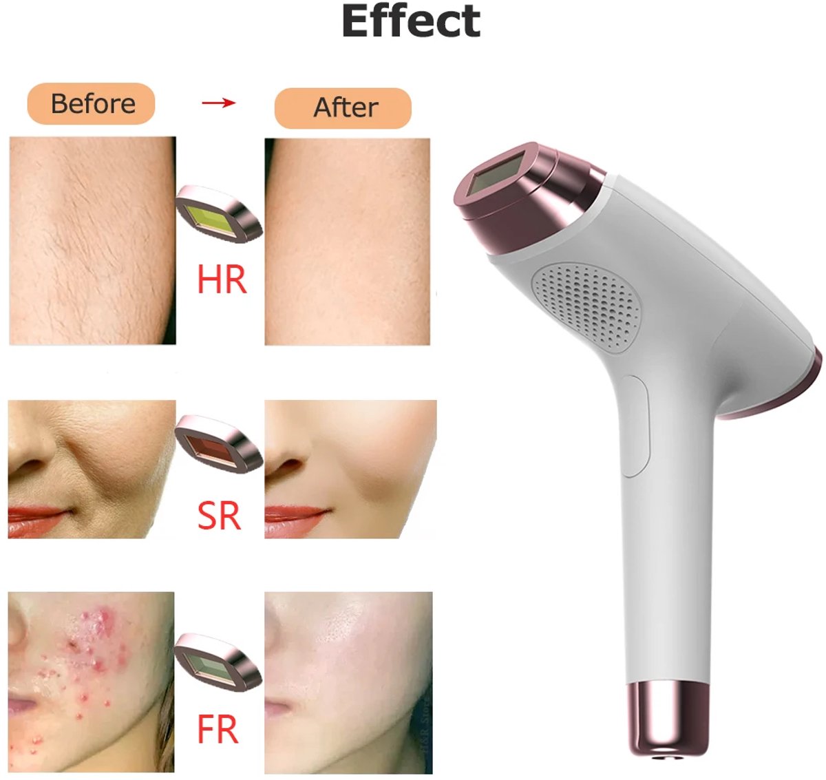 IPL Laser Ontharingsapparaat Haarverwijderaar 999.999 Flitsen - Inclusief Beschermbril & Scheermes