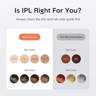 IPL Lichaamsontharingsapparaat review