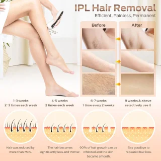 IPL-ontharingsapparaat 999.900 flitsen