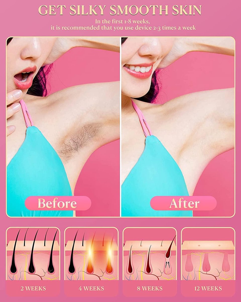 De IPL ontharingsapparaat 999.999 lichtpulsen inclusief make-uptas in één oogopslag