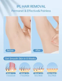 IPL Ontharingsapparaat Laser Gezicht & Lichaam
