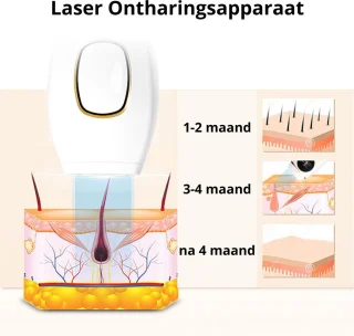 IPL Ontharingsapparaat - Roze