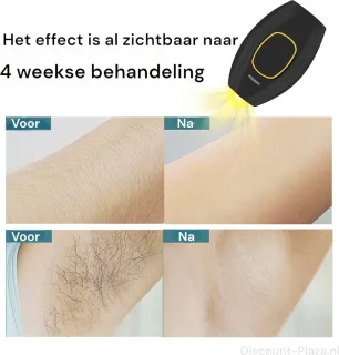 IPL Roze Ontharingsapparaat Inclusief Beschermbril