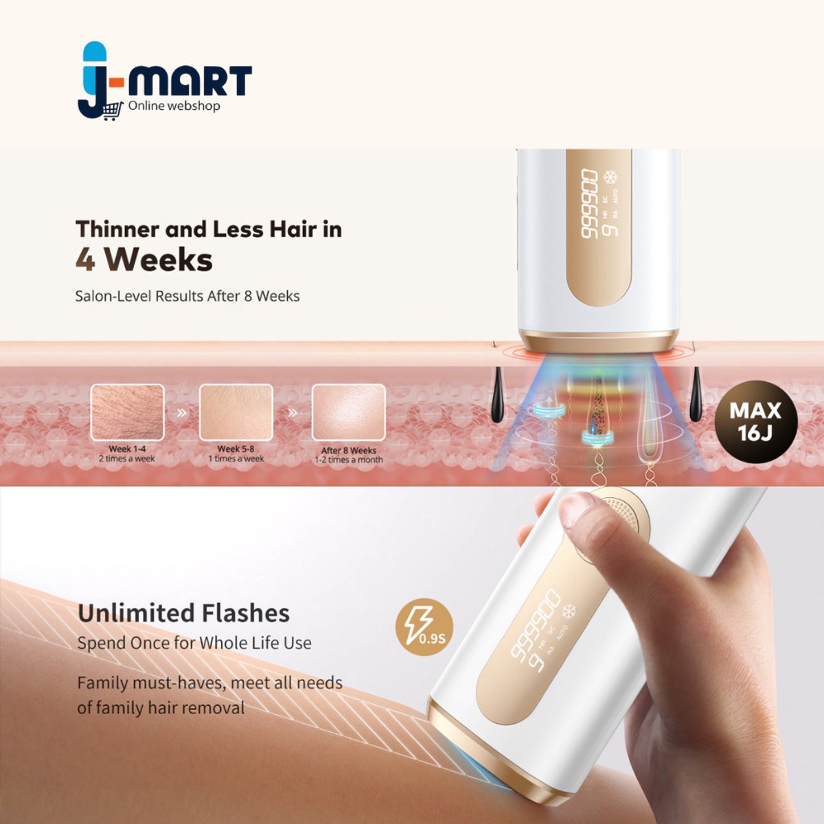J-Mart Laser Ontharingsapparaat