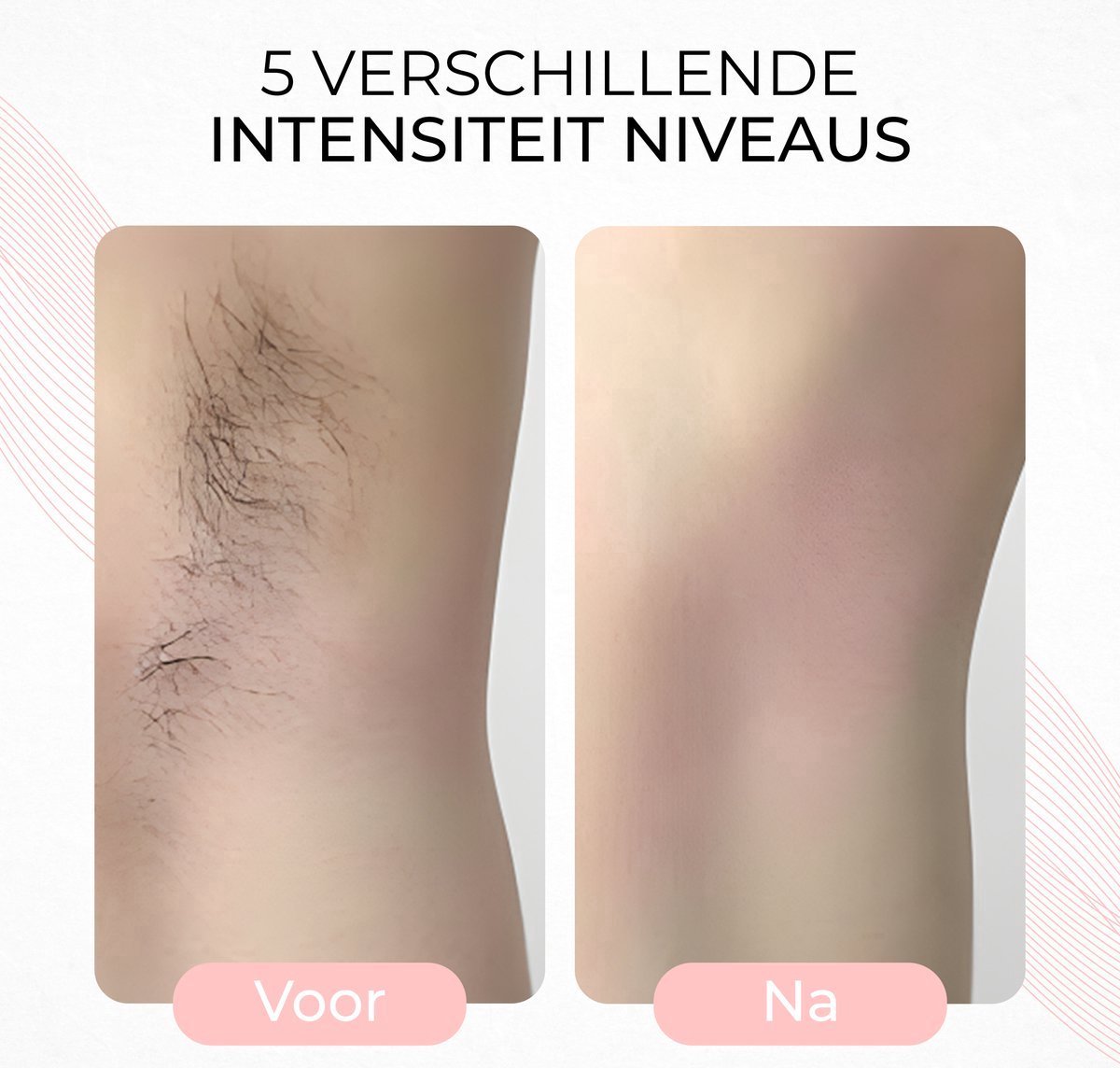 Laser IPL Epileerapparaat Dames Zwart