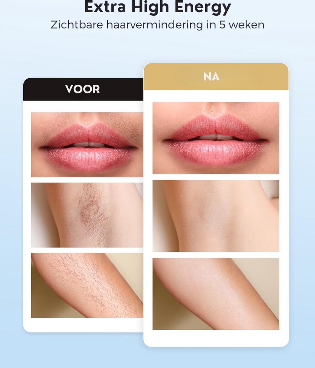 Wat vinden we goed aan de Laser Ontharingsapparaat 5 Niveaus met Koelelement