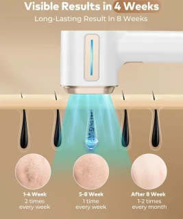 Laser Ontharingsapparaat Epilator Thuisgebruik