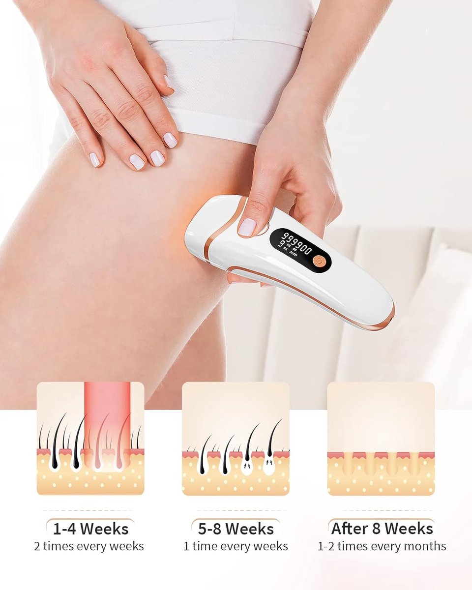Laser Ontharingsapparaat Epilator voor Thuisgebruik
