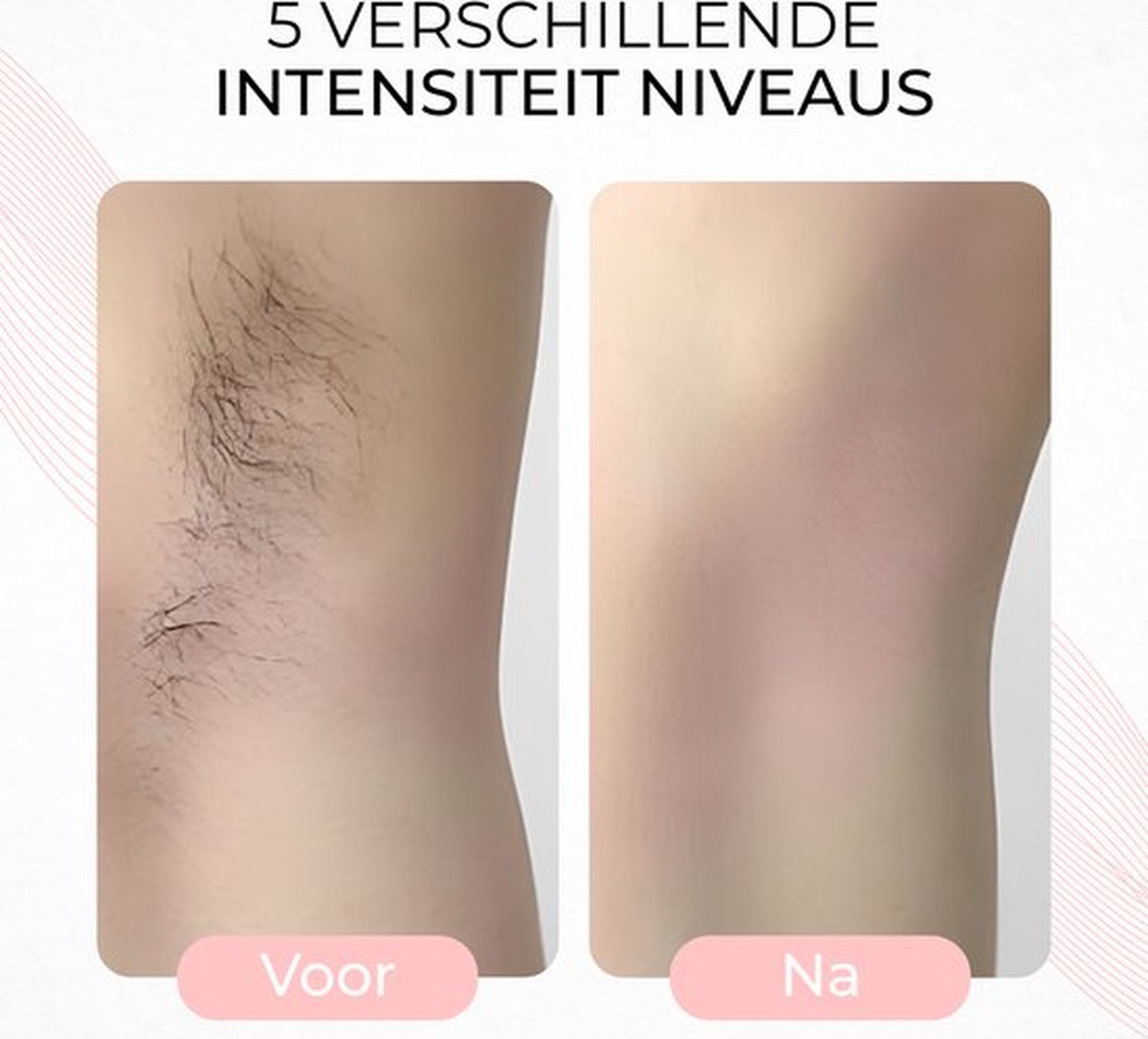 Laser Ontharingsapparaat IPL Epileerapparaat Dames Wit
