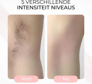 Laser Ontharingsapparaat IPL Epileerapparaat Dames Wit