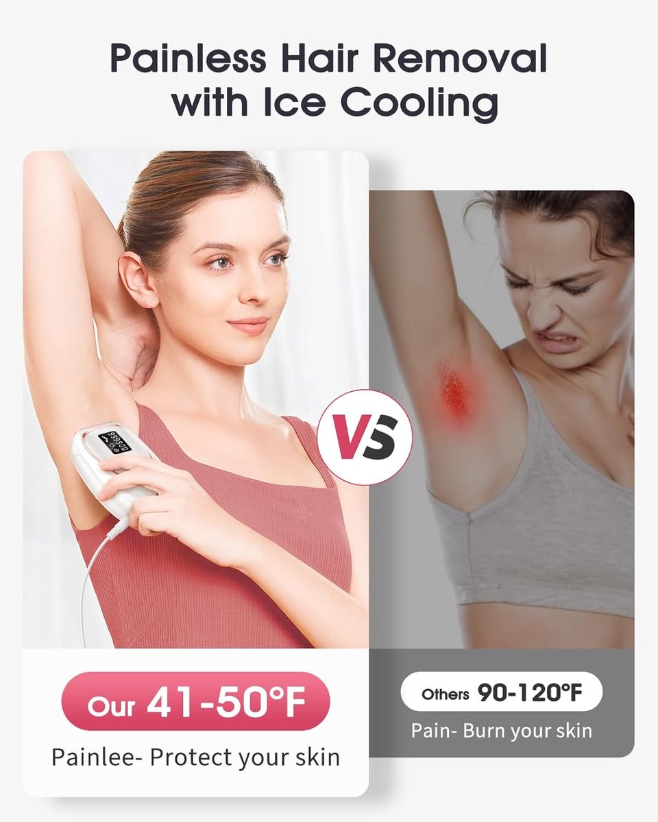 Wat vinden we goed aan de Laser Ontharingsapparaat IPL Wit/Roze voor Mannen & Vrouwen