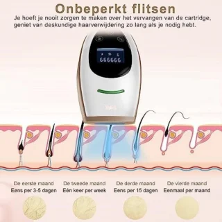 Laser Ontharingsapparaat voor Vrouwen