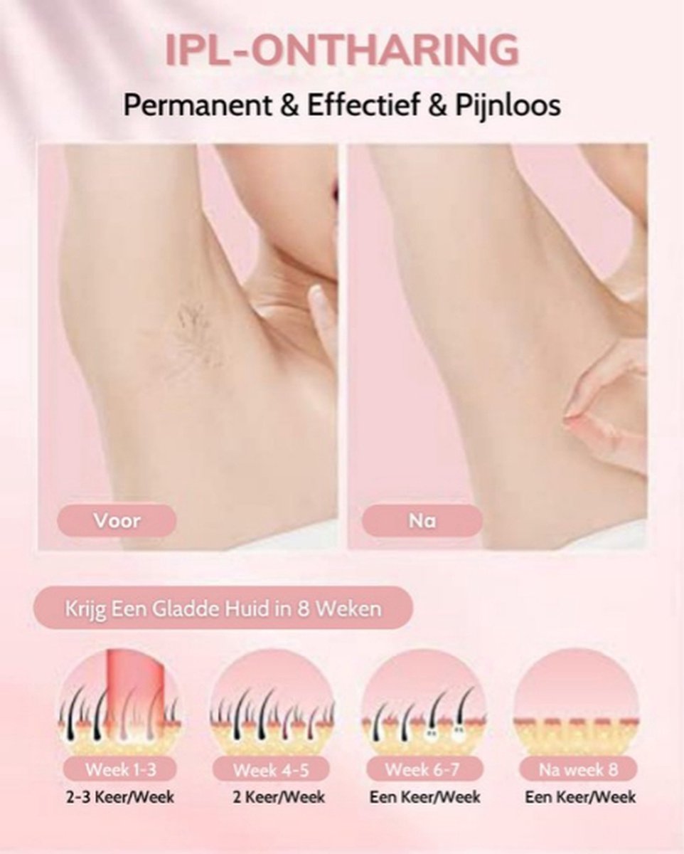 Wat vinden we goed aan de Laser Ontharingsapparaat Wit