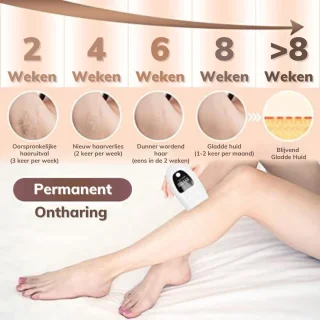 Laser Ontharingsapparaat Wit voor Vrouwen