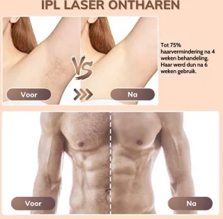 Laser Ontharingsapparaat Wit voor Vrouwen