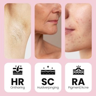Leafline IPL Laser Ontharingsapparaat Dames Epileerapparaat