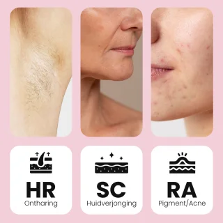 Leafline IPL Laser Ontharingsapparaat Dames Epileerapparaat