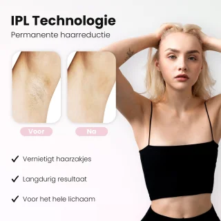 Leafline IPL Laser Ontharingsapparaat Dames Epileerapparaat