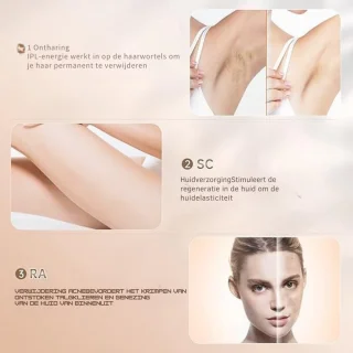 LifeStages Laser Ontharingsapparaat