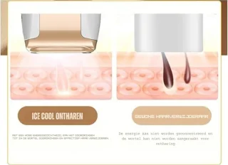 LifeStages Laser Ontharingsapparaat Voor Thuis