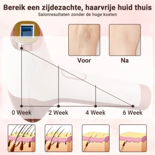 Lunivea IPL Laser Ontharingsapparaat Wit/Roze