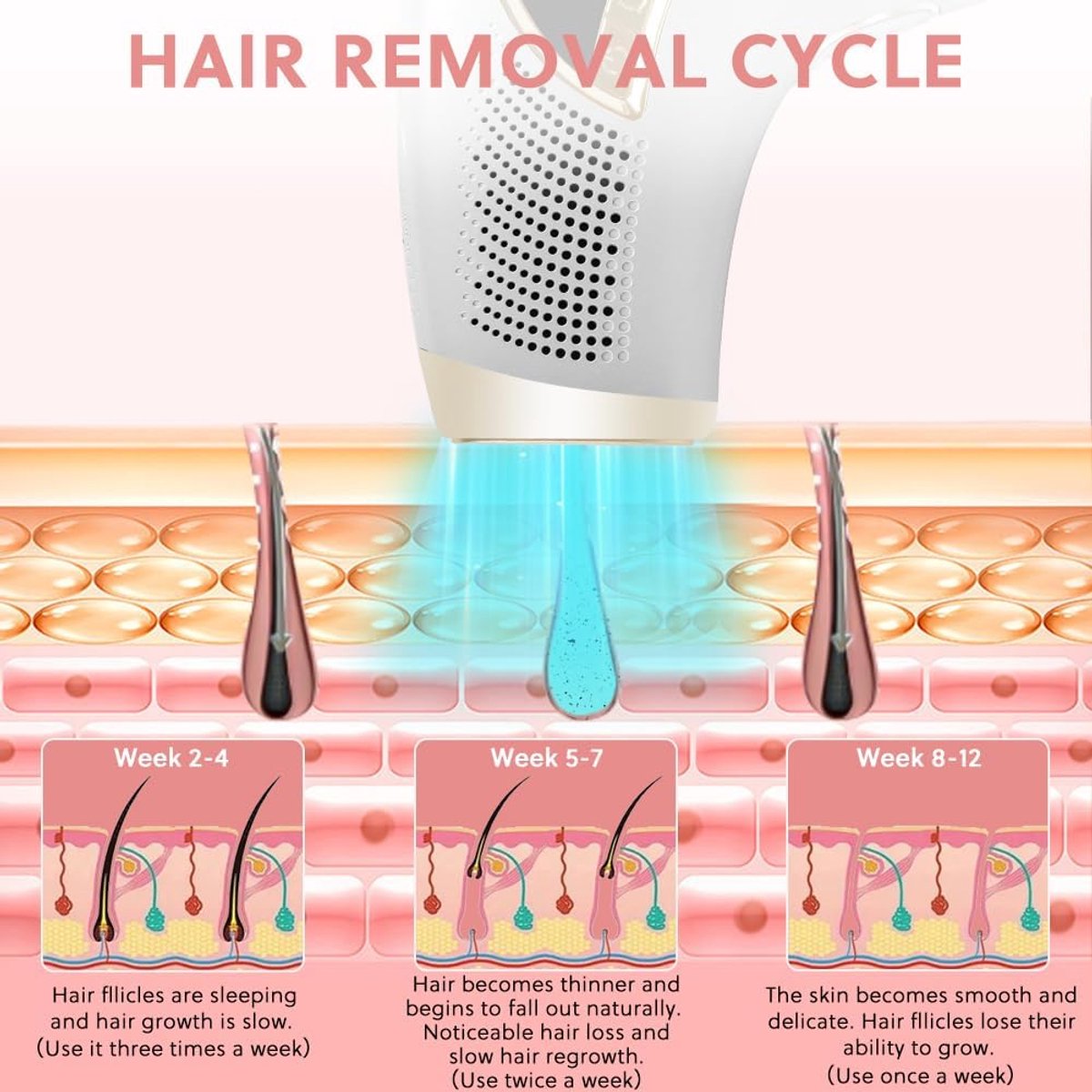 MKSS® IPL Laser Ontharingsapparaat