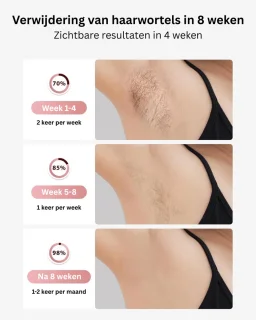 MKSS® IPL Laser Ontharingsapparaat Roze
