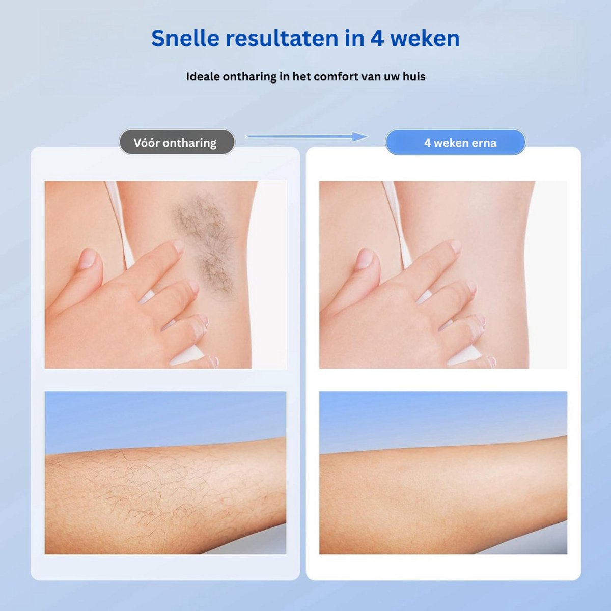MKSS® IPL Laser Ontharingsapparaat Wit