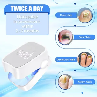 Nagelschimmel Laserapparaat