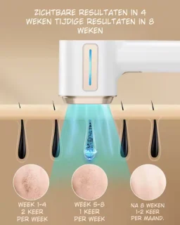 Nawy® IPL Laser Ontharingsapparaat (Epileerapparaat)