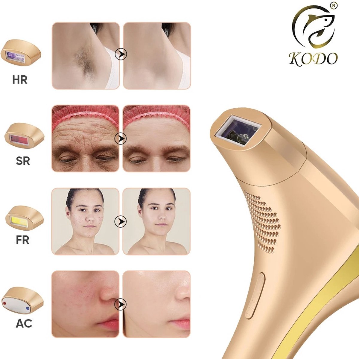 Ontharingsapparaat Laser Gezicht & Lichaam