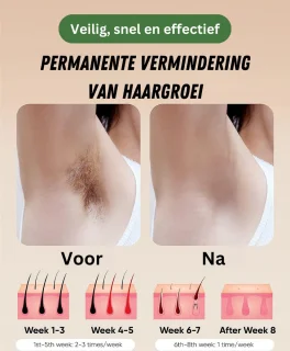 PEAM Permanente Ontharing apparaat voor vrouw en man