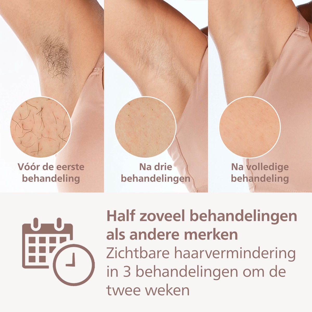 Philips Lumea IPL 9000 Series BRI955/01