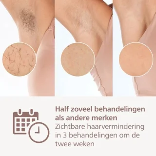 Philips Lumea IPL 9900 Series BRI950/02 Ontharingsapparaat