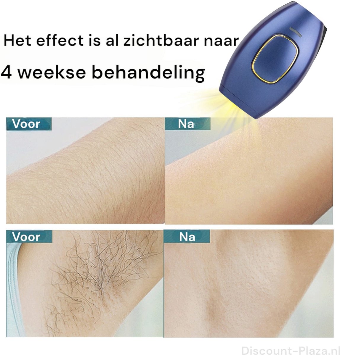 Premium IPL ontharingsapparaat Pruisisch blauw