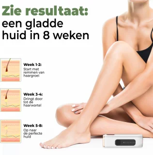 Professionele IPL Laser Ontharingsapparaat - 999.999 Flitsen - Inclusief Protectiebril en Scheermes