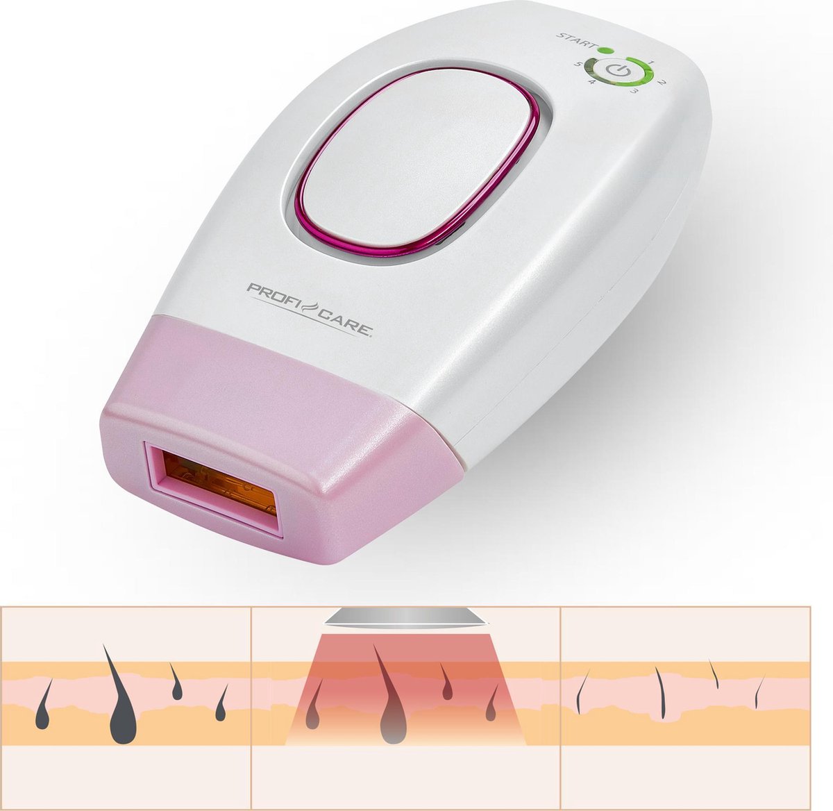ProfiCare PC-IPL 3024 IPL Epilator Pink White